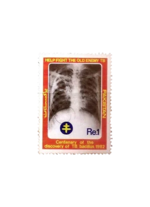 Centenary Of Discovery Of TB Bacillus