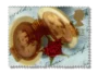 Double locket