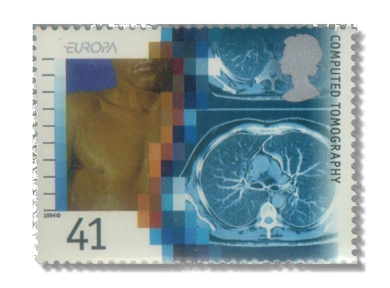 Computed tomography